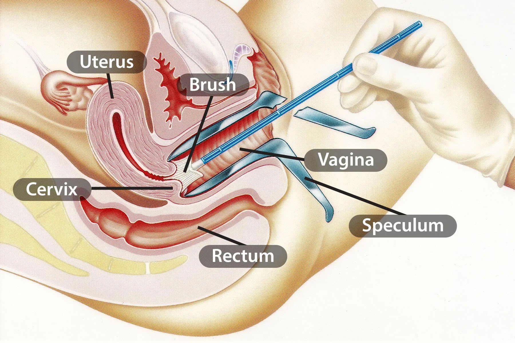 Pap Smear Test